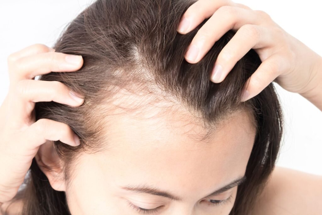 Hair Thinning Treatment