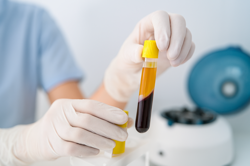 How PRP Therapy Works