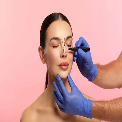 What are the benefits of rhinoplasty surgery in Riyadh? Rhinoplasty surgery in Riyadh 2