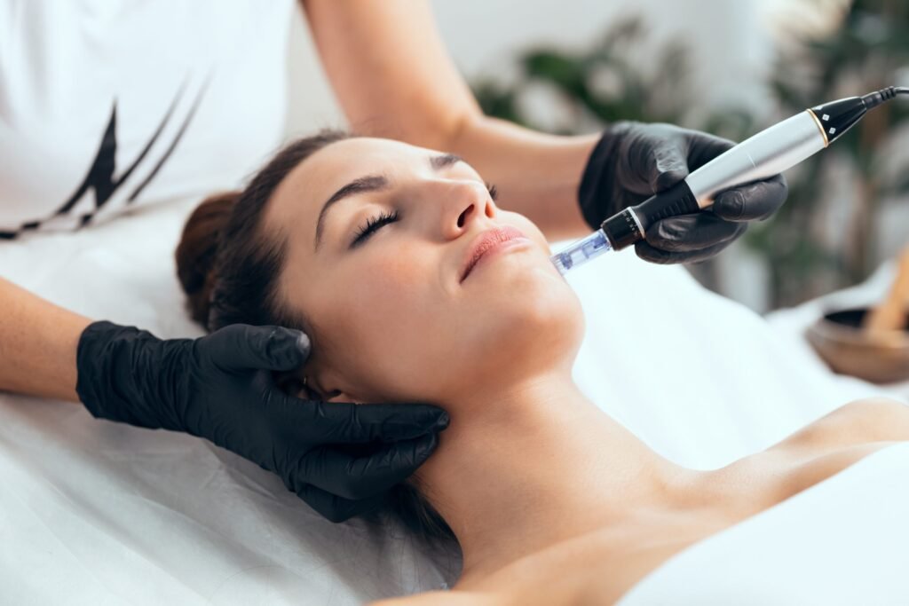 Microneedling treatment