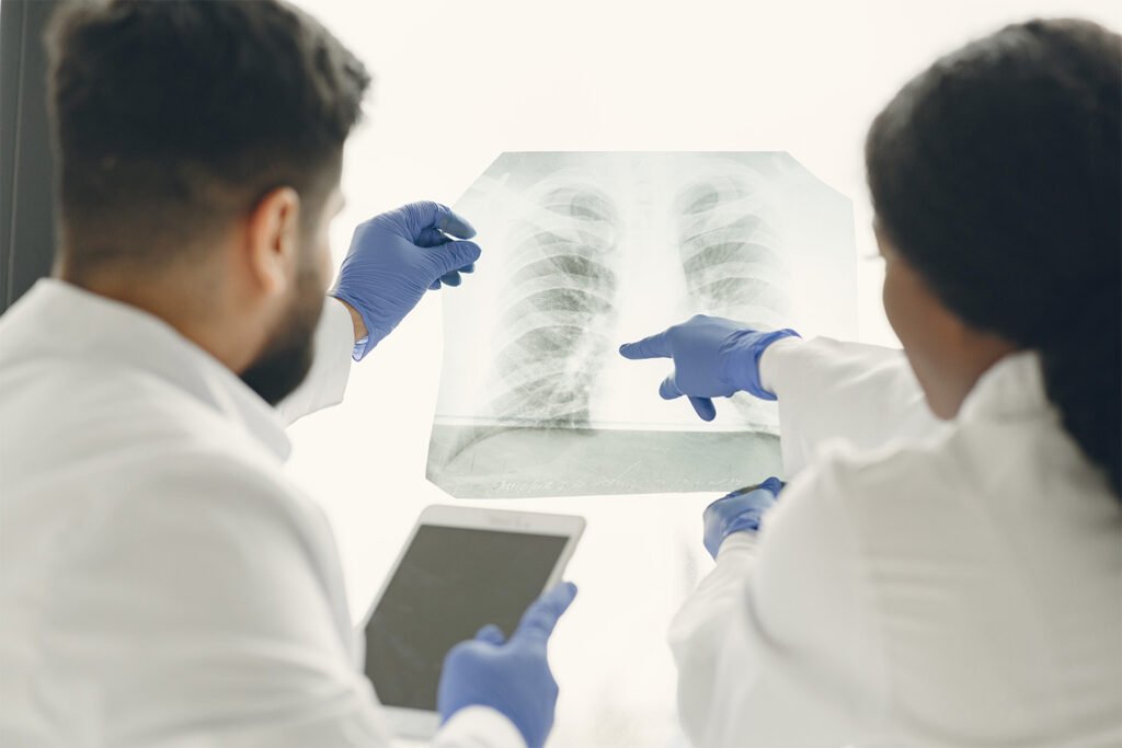 Pulmonology Care in Delhi