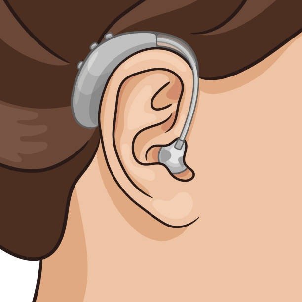 Receiver in Canal Hearing Aid Benefits Explained for Everyday Use