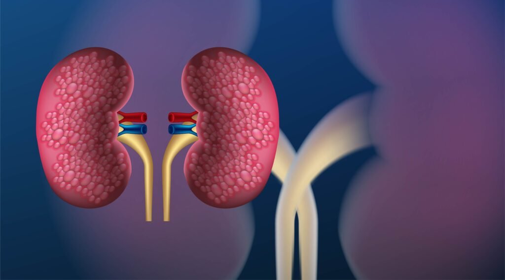 Acute Kidney Failure vs Chronic Kidney Disease.