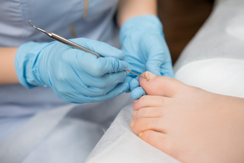 Does Ingrown Toenail Treatment Hurt? Everything You Need to Know ingrown toenail treatment