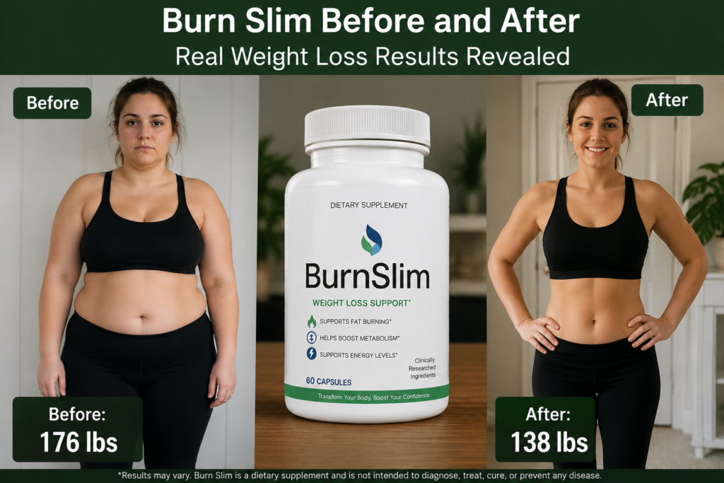 Burn Slim